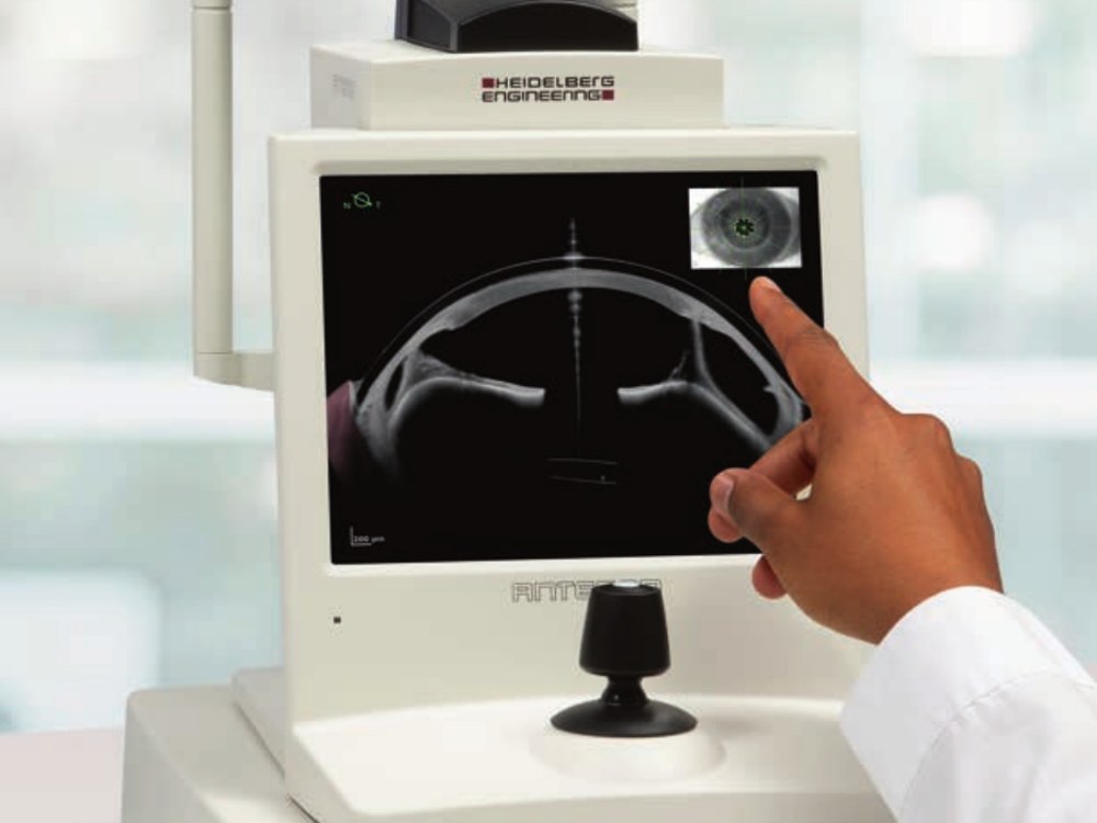 Heidelberg ANTERION swept-source OCT anterior segment imaging platform at Balaji Horizon Eye Hospital