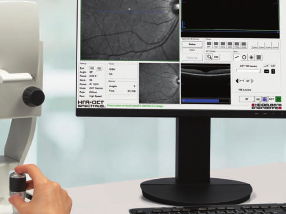 Heidelberg SPECTRALIS OCT with Glaucoma Module Premium Edition (GMPE)