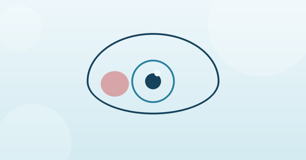 Minimal line-art eye with soft red patch on the white — subconjunctival haemorrhage (blood spot in eye) banner